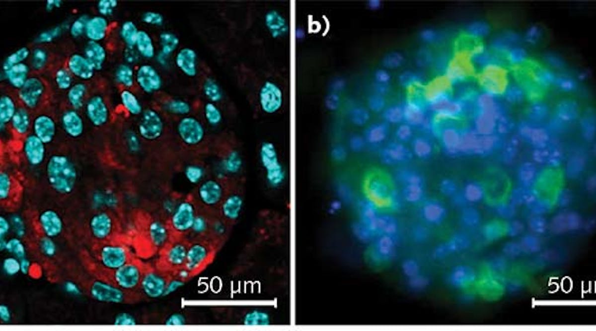 FIGURE 1. Investigating the pancreatic islet cells in mouse. The Olympus FV10i confocal microscope with 60x oil objective enables visualization of insulin-producing &beta;-cells within regions of the pancreas called islets of Langerhans, including a section staining for insulin (red), with nuclei in cyan (a); and islet cells in culture, with insulin (green) and nuclei stained in blue (b).