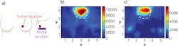 A schematic (a) shows the approximate tumor location and probe location of a 69-year-old female with invasive ductal carcinoma. Diffuse optical images (b) and (c) are collected underneath the breast using the fiber-optic imager; white dotted circles show locations where high absorption (red signal) may indicate increased vasculature and indicate tumor location. A schematic (a) shows the approximate tumor location and probe location of a 69-year-old female with invasive ductal carcinoma. Diffuse optical images (b) and (c) are collected underneath the breast using the fiber-optic imager; white dotted circles show locations where high absorption (red signal) may indicate increased vasculature and indicate tumor location.