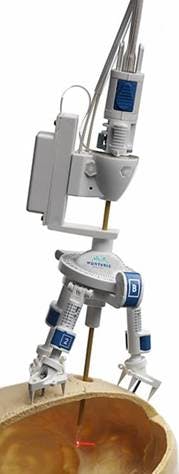 Neuroblate 1 Neuroblate 1