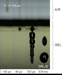 Ol Laser Drug Delivery Fig4a Ol Laser Drug Delivery Fig4a