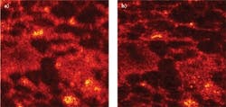 FIGURE 2. An OCT image of rat adipose tissue (a) is compared to an ISAM reconstruction from the same data (b); the images are nearly identical. The field of view is 500 × 500 μm. FIGURE 2. An OCT image of rat adipose tissue (a) is compared to an ISAM reconstruction from the same data (b); the images are nearly identical. The field of view is 500 × 500 μm.