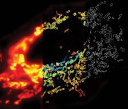 FIGURE 1. The mitochondrial outer membrane protein Tom20, labeled in a mammalian cell, as seen using conventional microscopy (left); in 3D using STORM, with z-dimension information coded according to the color bar (middle); and an XY cross section of the STORM image (right). FIGURE 1. The mitochondrial outer membrane protein Tom20, labeled in a mammalian cell, as seen using conventional microscopy (left); in 3D using STORM, with z-dimension information coded according to the color bar (middle); and an XY cross section of the STORM image (right).