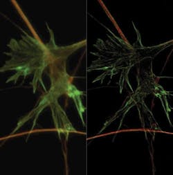 FIGURE 2. Widefield (left) and SIM (right) images of neuronal growth cones, with staining for tubulin (red) and F-actin (green). FIGURE 2. Widefield (left) and SIM (right) images of neuronal growth cones, with staining for tubulin (red) and F-actin (green).