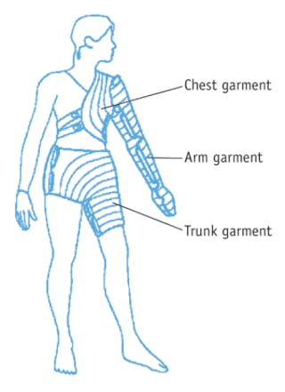FIGURE 1: A new optical imaging approach begins to answer the U.S. Centers for Medicare and Medicaid Services&apos; (CMS) challenge regarding evidence to support use of pneumatic compression devices (PCDs), such as the Flexitouch garment from Tactile Systems.