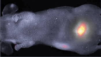 FIGURE 1. The width of the point-spread functions for interferometric synthetic aperture microscopy (ISAM) and optical coherence tomography (OCT) are shown as a function of distance from focus.
