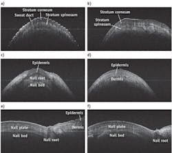 FIGURE 5. Real-time C-FD-OCT images, generated using GPU-NUFFT and displayed at 29.8 fps with original frame size of 4096 pixel (lateral) × 1024 pixel (axial), show (a) fingertip (coronal); (b) finger palm (coronal); (c-d) fingernail fold (coronal); and (e-f) fingernail (sagittal). FIGURE 5. Real-time C-FD-OCT images, generated using GPU-NUFFT and displayed at 29.8 fps with original frame size of 4096 pixel (lateral) × 1024 pixel (axial), show (a) fingertip (coronal); (b) finger palm (coronal); (c-d) fingernail fold (coronal); and (e-f) fingernail (sagittal).