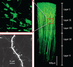 FIGURE 1. The Olympus Fluoview FV1000-MPE multiphoton system with a 60x objective can capture cross-sectional images down to 700 μm from the surface, as shown in these three-dimensionally constructed images of neurons expressing EYFP in the cerebral neocortex of a mouse under anesthesia. FIGURE 1. The Olympus Fluoview FV1000-MPE multiphoton system with a 60x objective can capture cross-sectional images down to 700 μm from the surface, as shown in these three-dimensionally constructed images of neurons expressing EYFP in the cerebral neocortex of a mouse under anesthesia.