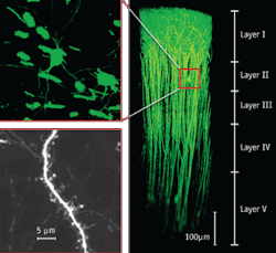 FIGURE 1. The Olympus Fluoview FV1000-MPE multiphoton system with a 60x objective can capture cross-sectional images down to 700 &mu;m from the surface, as shown in these three-dimensionally constructed images of neurons expressing EYFP in the cerebral neocortex of a mouse under anesthesia.