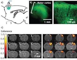 FIGURE 1. An optogenetic functional magnetic resonance imaging (ofMRI) technique delivers 473 nm blue light to the motor cortex region of a rat’s brain (a). The channelrhodopsin (ChR2) expressing region in the brain is co-localized with the fluorescent tag as shown in the confocal microscopy images (b). A blood-oxygenation-level dependent (BOLD) signal appears in the light-activated brain (c; right) in the presence of ChR2, but not in the brain treated with a saline injection (c; left), indicating that selective stimulation of excitatory neurons expressing ChR2 is the source of the BOLD signal. FIGURE 1. An optogenetic functional magnetic resonance imaging (ofMRI) technique delivers 473 nm blue light to the motor cortex region of a rat’s brain (a). The channelrhodopsin (ChR2) expressing region in the brain is co-localized with the fluorescent tag as shown in the confocal microscopy images (b). A blood-oxygenation-level dependent (BOLD) signal appears in the light-activated brain (c; right) in the presence of ChR2, but not in the brain treated with a saline injection (c; left), indicating that selective stimulation of excitatory neurons expressing ChR2 is the source of the BOLD signal.