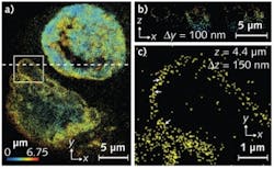 Three-dimensional PALM images of two nuclei containing lamin proteins. Defects in these proteins are responsible for a range of conditions, including muscular dystrophy and premature aging. (a) Shows a projection view of the two nuclei labeled with pa-m Cherry1 lamin B1. Color indicates axial depth. (b) An xz slice along the dotted line. (c) A zoom-in of the boxed region in (a). Arrows indicate regions of the membrane resolved in xy to < 100 nm. Three-dimensional PALM images of two nuclei containing lamin proteins. Defects in these proteins are responsible for a range of conditions, including muscular dystrophy and premature aging. (a) Shows a projection view of the two nuclei labeled with pa-m Cherry1 lamin B1. Color indicates axial depth. (b) An xz slice along the dotted line. (c) A zoom-in of the boxed region in (a). Arrows indicate regions of the membrane resolved in xy to < 100 nm.