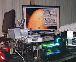 FIGURE 4. The fiber-optic probe in the biomedical optics lab at Oregon Health & Science University (in hand). The blue and green lasers feed a multimodal confocal microscope that mimics hematoxylin and eosin (H&E) histology. The red laser is a line-scanning microscope. The computer display shows the pattern of nevus (top) versus melanoma (bottom). FIGURE 4. The fiber-optic probe in the biomedical optics lab at Oregon Health & Science University (in hand). The blue and green lasers feed a multimodal confocal microscope that mimics hematoxylin and eosin (H&E) histology. The red laser is a line-scanning microscope. The computer display shows the pattern of nevus (top) versus melanoma (bottom).