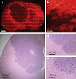 FIGURE 4. Coherent anti-Stokes Raman scattering (CARS) provides label-free, in-situ visualization of the margins of a mouse tumor (dark area in upper left image); it also allows extreme closeup imaging of the same tumor (area in white square). The method compares favorably with conventional stained tissue slices of another mouse with a brain tumor, with normal tissue (pink) and cancerous tissue (purple) clearly identified; however, the mouse was sacrificed to obtain the image.