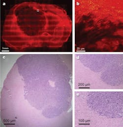 FIGURE 4. Coherent anti-Stokes Raman scattering (CARS) provides label-free, in-situ visualization of the margins of a mouse tumor (dark area in upper left image); it also allows extreme closeup imaging of the same tumor (area in white square). The method compares favorably with conventional stained tissue slices of another mouse with a brain tumor, with normal tissue (pink) and cancerous tissue (purple) clearly identified; however, the mouse was sacrificed to obtain the image. FIGURE 4. Coherent anti-Stokes Raman scattering (CARS) provides label-free, in-situ visualization of the margins of a mouse tumor (dark area in upper left image); it also allows extreme closeup imaging of the same tumor (area in white square). The method compares favorably with conventional stained tissue slices of another mouse with a brain tumor, with normal tissue (pink) and cancerous tissue (purple) clearly identified; however, the mouse was sacrificed to obtain the image.