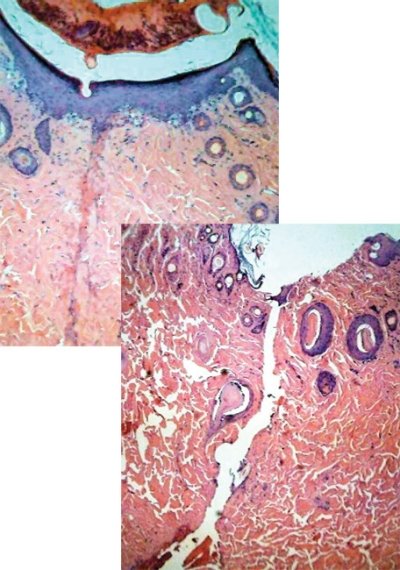 Two 40X histology images of in-vivo skin samples on a guinea pig after seven postoperative days show a well-opposed surgical incision and no significant inflammatory cell infiltration. However, serial sections of the area 'welded' using a 1535 nm femtosecond laser (top left) show almost complete wound healing in the epidermis and granulation tissue in the dermis, while the sutured control (left) serial sections show very minimal wound healing in epidermis and minimal granulation tissue in dermis.