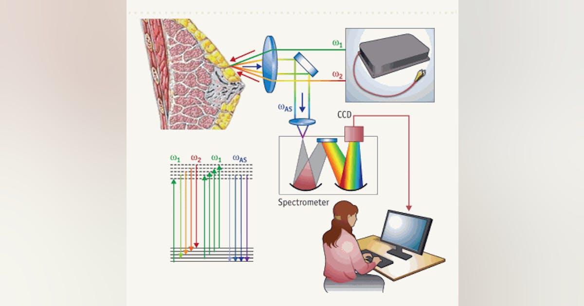 SPECTROSCOPY/MICROSCOPY: Nonlinear Raman microscopy eyes clinical ...