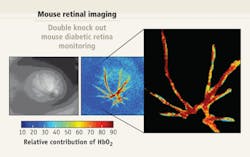 FIGURE 2. Clinicians can use hyperspectral imaging also to measure the percentage of oxyhemoglobin within retinal microvasculature. Here, the technique imaged the retina of a mouse genetically predisposed to developing diabetic retinopathy. FIGURE 2. Clinicians can use hyperspectral imaging also to measure the percentage of oxyhemoglobin within retinal microvasculature. Here, the technique imaged the retina of a mouse genetically predisposed to developing diabetic retinopathy.