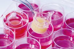 Pm Artivasc Abschlusspr Sentation Oktober 2015 Bild 2 Web Pm Artivasc Abschlusspr Sentation Oktober 2015 Bild 2 Web