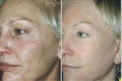 Th 0708ilsrejuvenat01 Th 0708ilsrejuvenat01