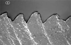 Th 0712ilslaserassisted04 Th 0712ilslaserassisted04