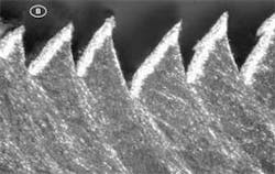 Th 0712ilslaserassisted05 Th 0712ilslaserassisted05