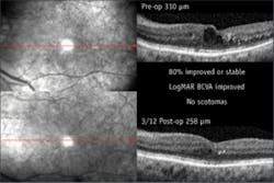 Th 0801bow News03 Th 0801bow News03