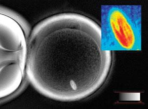 Using the Oosight noninvasive polarized-light microscope from CRi, a human egg can be imaged according to its birefringence. Of particular importance is the spindle, the bright object near the bottom of the egg (and in close-up in inset); without this imaging tool the spindle would be virtually invisible except through the use of fluorescence techniques, which are damaging to the egg.