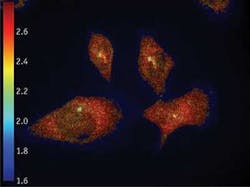 FIGURE 1. Cells are labeled with Alexa488 and Alexa568 in a fluorescence-lifetime image, merged with intensity in grayscale, obtained using the LIFA frequency-domain FLIM system. The lifetime of the Alexa488 is shown and a clear decrease is visible where the Alexa488 and Alexa568 are interacting with each other (FRET) at the centrosomes (the microtubule organizing centers inside the cell that are required for cell-cycle progression through G1-S phase). FIGURE 1. Cells are labeled with Alexa488 and Alexa568 in a fluorescence-lifetime image, merged with intensity in grayscale, obtained using the LIFA frequency-domain FLIM system. The lifetime of the Alexa488 is shown and a clear decrease is visible where the Alexa488 and Alexa568 are interacting with each other (FRET) at the centrosomes (the microtubule organizing centers inside the cell that are required for cell-cycle progression through G1-S phase).