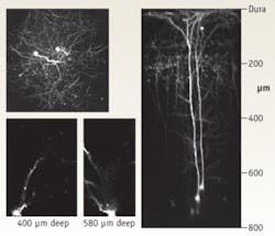 FIGURE 1. This z-axis image was reconstructed from a stack of 160 separate xy image slices, 5 µm apart. It was recorded in vivo from an anesthetized mouse through a glass cranial window using 910 nm two-photon excitation and shows two layer 5 cortical neurons transgenically labeled with GFP. The benefits of high power and optimized pulsewidth can be seen in the z-axis image slice of a cortical neuron of the mouse brain, which has a total depth of 800 µm. FIGURE 1. This z-axis image was reconstructed from a stack of 160 separate xy image slices, 5 µm apart. It was recorded in vivo from an anesthetized mouse through a glass cranial window using 910 nm two-photon excitation and shows two layer 5 cortical neurons transgenically labeled with GFP. The benefits of high power and optimized pulsewidth can be seen in the z-axis image slice of a cortical neuron of the mouse brain, which has a total depth of 800 µm.