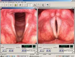 Th 0803bow Fea4f3 Th 0803bow Fea4f3