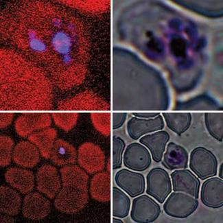 Using two-photon fluorescence (red, left) and third-harmonic generation (blue, left), researchers at McGill University have been able to more quickly and accurately image plasmodium falciparum-infected red blood cells (indicators of malaria). Images on the right are normal microscope images of the same area.