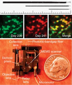 FIGURE 2. A portable fluorescence microendoscope can utilize three GRIN-lens probes, 1000, 500, and 350 microns in diameter (top). Two-photon microendoscopy was used to obtain images of hippocampal pyramidal cell bodies and proximal dendrites expressing YFP in a live mouse (center). In the portable fiber-optic two-photon microendoscope, the scanning mirror is microfabricated in silicon by photolithography methods and deflects light in two angular dimensions with a fast-axis scanning rate of 1.7 kHz (bottom). FIGURE 2. A portable fluorescence microendoscope can utilize three GRIN-lens probes, 1000, 500, and 350 microns in diameter (top). Two-photon microendoscopy was used to obtain images of hippocampal pyramidal cell bodies and proximal dendrites expressing YFP in a live mouse (center). In the portable fiber-optic two-photon microendoscope, the scanning mirror is microfabricated in silicon by photolithography methods and deflects light in two angular dimensions with a fast-axis scanning rate of 1.7 kHz (bottom).