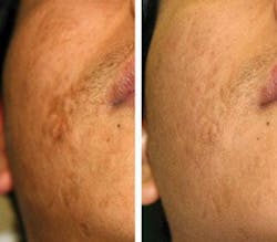 Th 0807bow News05 Th 0807bow News05