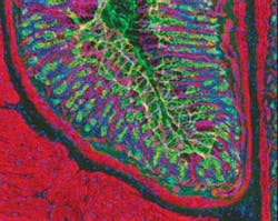 Fluorescent optical filters and dyes make it possible to label specific cells, as seen in this section of a rat’s stomach. Fluorescent optical filters and dyes make it possible to label specific cells, as seen in this section of a rat’s stomach.