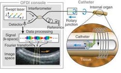 FIGURE 3. In an optical frequency-domain imaging system, minimally invasive catheters or endoscopes give the optical fiber access to the organ or system of interest. An optical beam is focused into the tissue, and the echo time delay and amplitude of light reflected from the tissue microstructure at different depths are determined by detecting spectrally resolved interference between the tissue sample and a reference, as the source laser wavelength is rapidly varied from 1264 to 1376 nm. A Fourier transform of this signal forms image data along the axial line (A-line). FIGURE 3. In an optical frequency-domain imaging system, minimally invasive catheters or endoscopes give the optical fiber access to the organ or system of interest. An optical beam is focused into the tissue, and the echo time delay and amplitude of light reflected from the tissue microstructure at different depths are determined by detecting spectrally resolved interference between the tissue sample and a reference, as the source laser wavelength is rapidly varied from 1264 to 1376 nm. A Fourier transform of this signal forms image data along the axial line (A-line).
