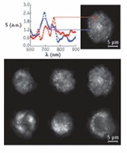 FIGURE 1. Spectral oscillations (top left) distinguish two organelles in data gathered from human bronchial epithelial cells with “confocal light absorption and scattering spectroscopic” (CLASS) microscopy. A reconstructed cross section of the cell (top right) also shows the two organelles. CLASS even reveals changes in cells before (bottom, upper row) and after (bottom, lower row) treatment with docosahexaenoic acid, which leads to cell death and makes the cells appear hollow. FIGURE 1. Spectral oscillations (top left) distinguish two organelles in data gathered from human bronchial epithelial cells with “confocal light absorption and scattering spectroscopic” (CLASS) microscopy. A reconstructed cross section of the cell (top right) also shows the two organelles. CLASS even reveals changes in cells before (bottom, upper row) and after (bottom, lower row) treatment with docosahexaenoic acid, which leads to cell death and makes the cells appear hollow.