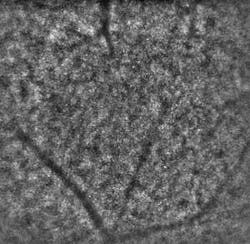 Figure 3. These cone photoreceptor cells and retinal capillaries belong to a patient presenting 5 diopters of astigmatism. Figure 3. These cone photoreceptor cells and retinal capillaries belong to a patient presenting 5 diopters of astigmatism.