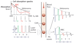 FIGURE 2. A time-resolved multicolor photoacoustic flow-cytometry system is able to identify pigmented melanoma cells in blood flow by using short laser pulses of different wavelengths (λ) interspersed with time delay (T). FIGURE 2. A time-resolved multicolor photoacoustic flow-cytometry system is able to identify pigmented melanoma cells in blood flow by using short laser pulses of different wavelengths (λ) interspersed with time delay (T).
