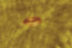 FIGURE 3. This single live red blood cell, captured with a high-speed camera in lymph flow, has a telltale shape. FIGURE 3. This single live red blood cell, captured with a high-speed camera in lymph flow, has a telltale shape.