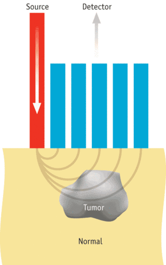 A SORS probe interrogates a lumpectomy specimen to determine margin status.