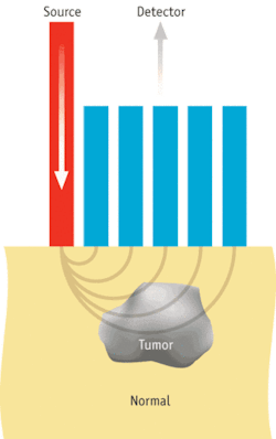 A SORS probe interrogates a lumpectomy specimen to determine margin status. A SORS probe interrogates a lumpectomy specimen to determine margin status.