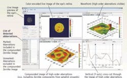 FIGURE 4. The digital wavefront camera’s wavefront analysis display shows evaluation of a simulated eye. FIGURE 4. The digital wavefront camera’s wavefront analysis display shows evaluation of a simulated eye.