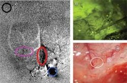FIGURE 2. The results of a laser-evoked hemodynamic signal at 630 nm illumination (a) include an intrinsic signal (darkening; red circle) in response to laser stimulation; over bone (black circle); centered on fiber (blue circle); forepaw motor region (purple outlines). The optical fiber is shown within the cortical field of view (b). The cortical field of view is shown following laser stimulation (c). The white circle outlines the stimulated area, revealing an absence of obvious cortical surface damage. The development of the intrinsic signal in response to laser (bottom, left) and vibrotactile (bottom, right) stimulation (from piezo actuators on forepaw) is shown over time. The red, black, blue, and purple traces correspond to the regions of interest (ROIs) depicted in (a). Except for the area directly over the laser, the similarity of the signals for the different ROIs suggests that the neural responses evoked by the laser are comparable to natural stimulation. FIGURE 2. The results of a laser-evoked hemodynamic signal at 630 nm illumination (a) include an intrinsic signal (darkening; red circle) in response to laser stimulation; over bone (black circle); centered on fiber (blue circle); forepaw motor region (purple outlines). The optical fiber is shown within the cortical field of view (b). The cortical field of view is shown following laser stimulation (c). The white circle outlines the stimulated area, revealing an absence of obvious cortical surface damage. The development of the intrinsic signal in response to laser (bottom, left) and vibrotactile (bottom, right) stimulation (from piezo actuators on forepaw) is shown over time. The red, black, blue, and purple traces correspond to the regions of interest (ROIs) depicted in (a). Except for the area directly over the laser, the similarity of the signals for the different ROIs suggests that the neural responses evoked by the laser are comparable to natural stimulation.