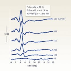 Figure 4. Optically evoked auditory brainstem response (oABR) amplitudes increase with higher radiant exposure levels. oABRs were recorded during surface stimulation of the left cochlear nucleus with a low-power, pulsed infrared laser. Figure 4. Optically evoked auditory brainstem response (oABR) amplitudes increase with higher radiant exposure levels. oABRs were recorded during surface stimulation of the left cochlear nucleus with a low-power, pulsed infrared laser.