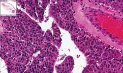 Th Largest 1109 01 Th Largest 1109 01