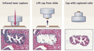 Laser Microdissection Techniques For Cell-specific Molecular Profiling ...