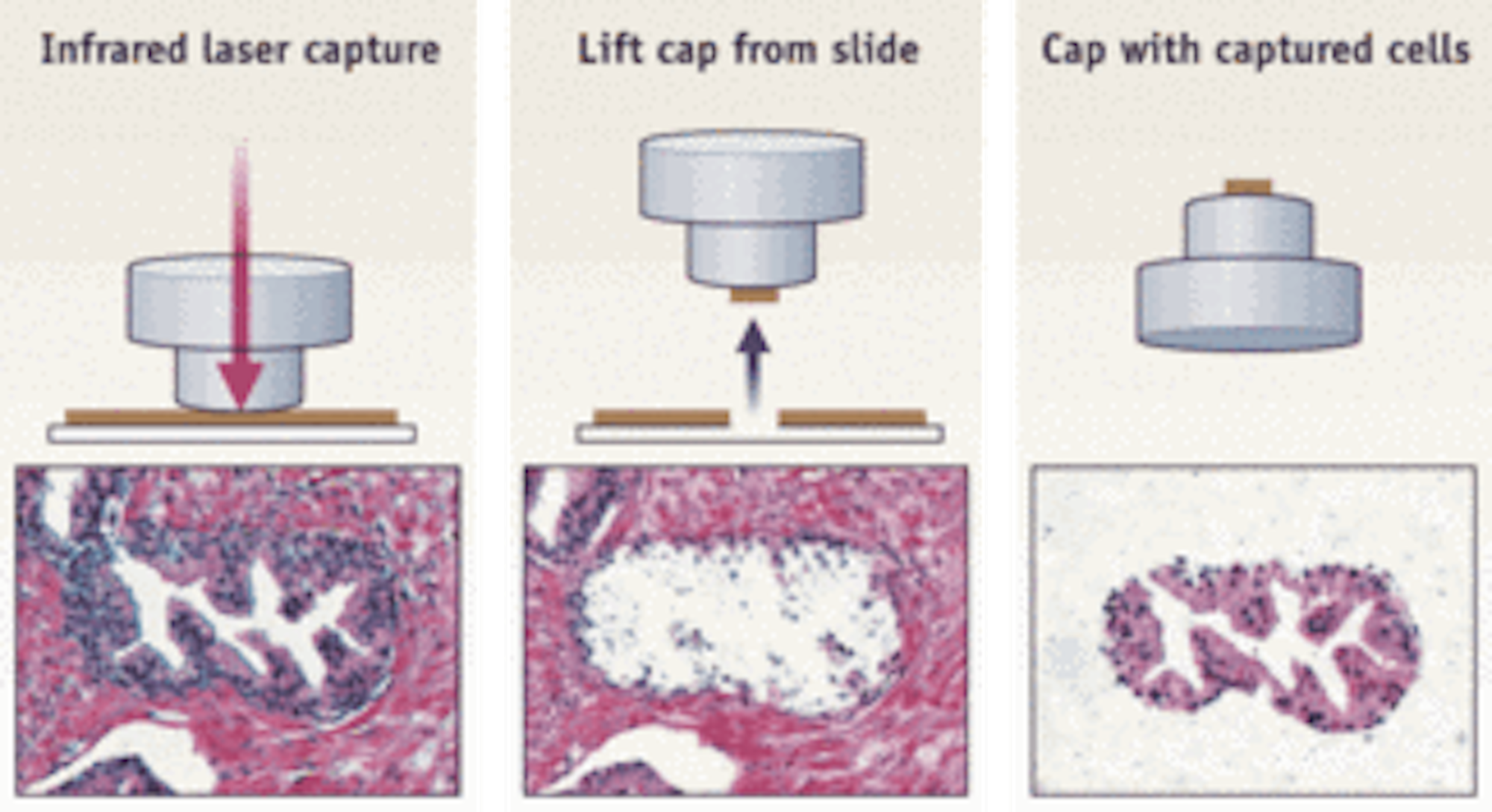 Laser microdissection techniques for cell-specific molecular profiling ...