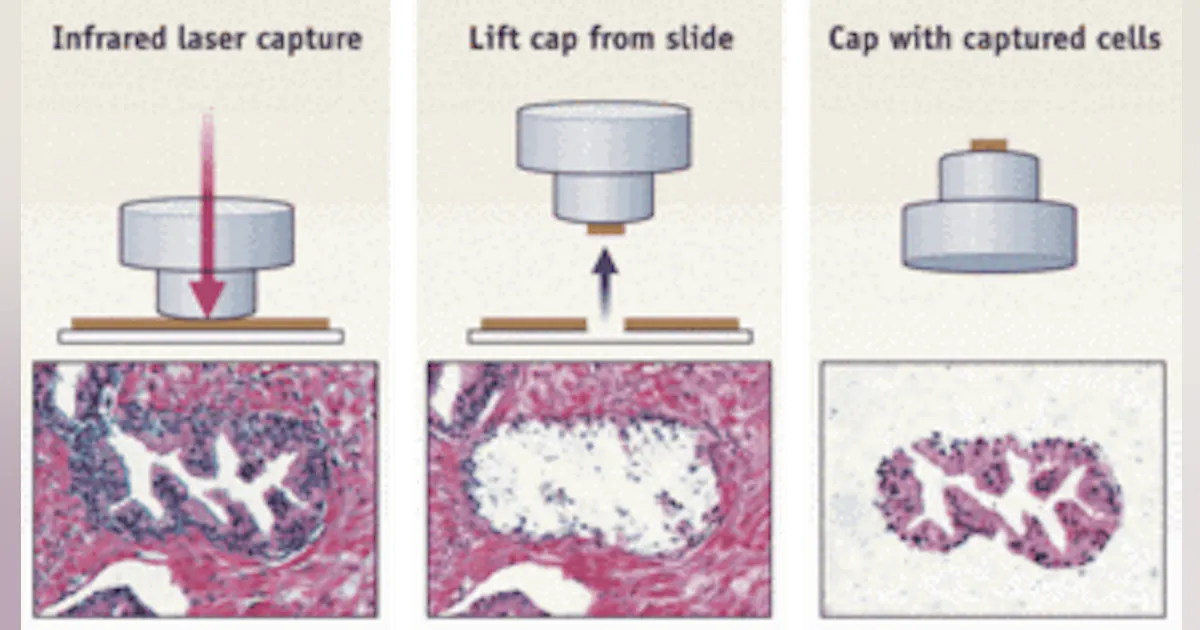 Cell Microdisection Laser microdissection techniques for cell-specific molecular profiling ...