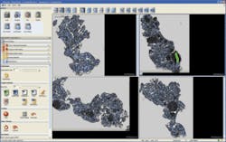 FIGURE 3. With Definiens Tissue Studio, a user can load up to four images at once and interactively train the system to recognize regions of interest. FIGURE 3. With Definiens Tissue Studio, a user can load up to four images at once and interactively train the system to recognize regions of interest.