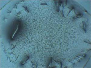 Figure 1. Results of work done to make a crystalline form of a protein can be difficult to see under visible light (top), but protein crystals become quite clear under ultraviolet light at 280 nm (bottom). Moreover, at 280 nm, protein crystals can be distinguished from salts.