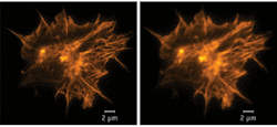 FIGURE 2. The actin cytoskeleton of a neuronal growth cone, stained with Alexa488-phalloidin, as revealed by structured illumination microscopy (SIM; left) and wide-field imaging (right). FIGURE 2. The actin cytoskeleton of a neuronal growth cone, stained with Alexa488-phalloidin, as revealed by structured illumination microscopy (SIM; left) and wide-field imaging (right).